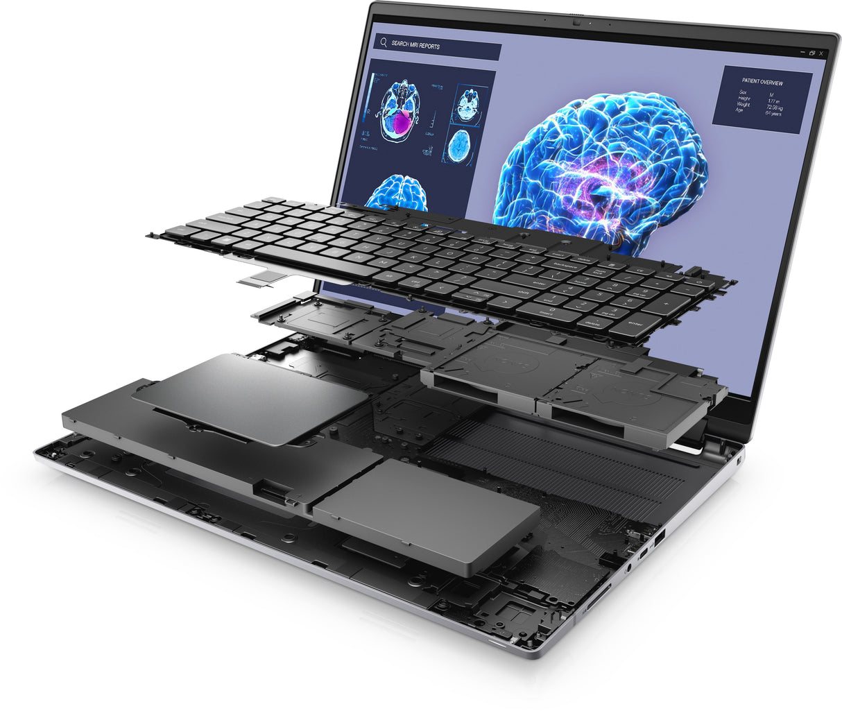 EAN 5397184810293 - DELL Precision 7680 Intel® Core™ i7 i7-13850HX Estación de trabajo móvil 40,6 cm (16") Full HD+ 32 GB DDR imagen 5