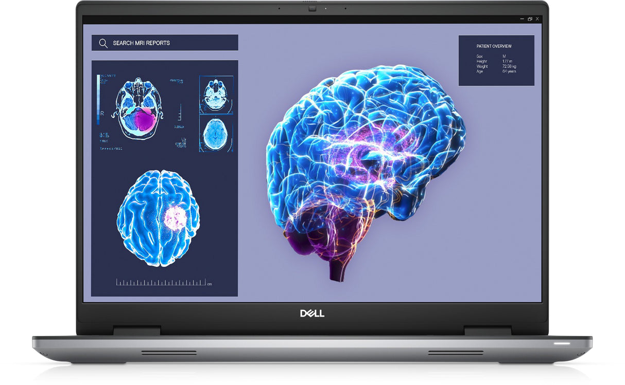 Portátil Dell Workstation Precision 7680 I7-13850hx 32gb 1tb 16" Fhd+ Nvidia Rtx 3500 Smtcd W11p