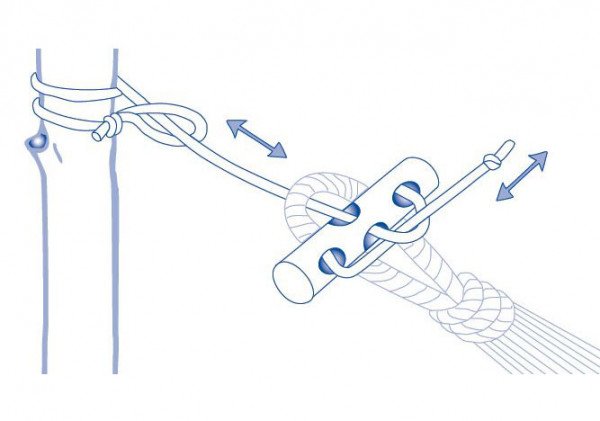 Microrope De Amazona, Fijación/Ensamblaje Az-3027000