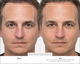 Masajeador  Therabody Theraface Pro Cara Negro