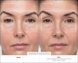 Masajeador  Therabody Theraface Pro Cara Negro