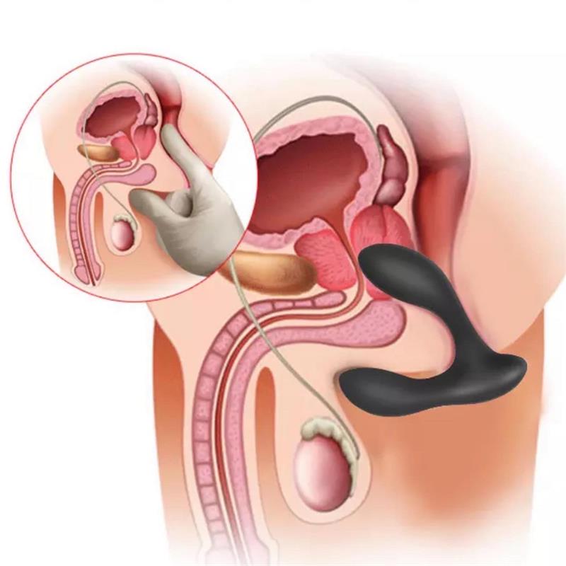 Brett Masajeador Prostático Control Remoto Usb Silicona Líquida