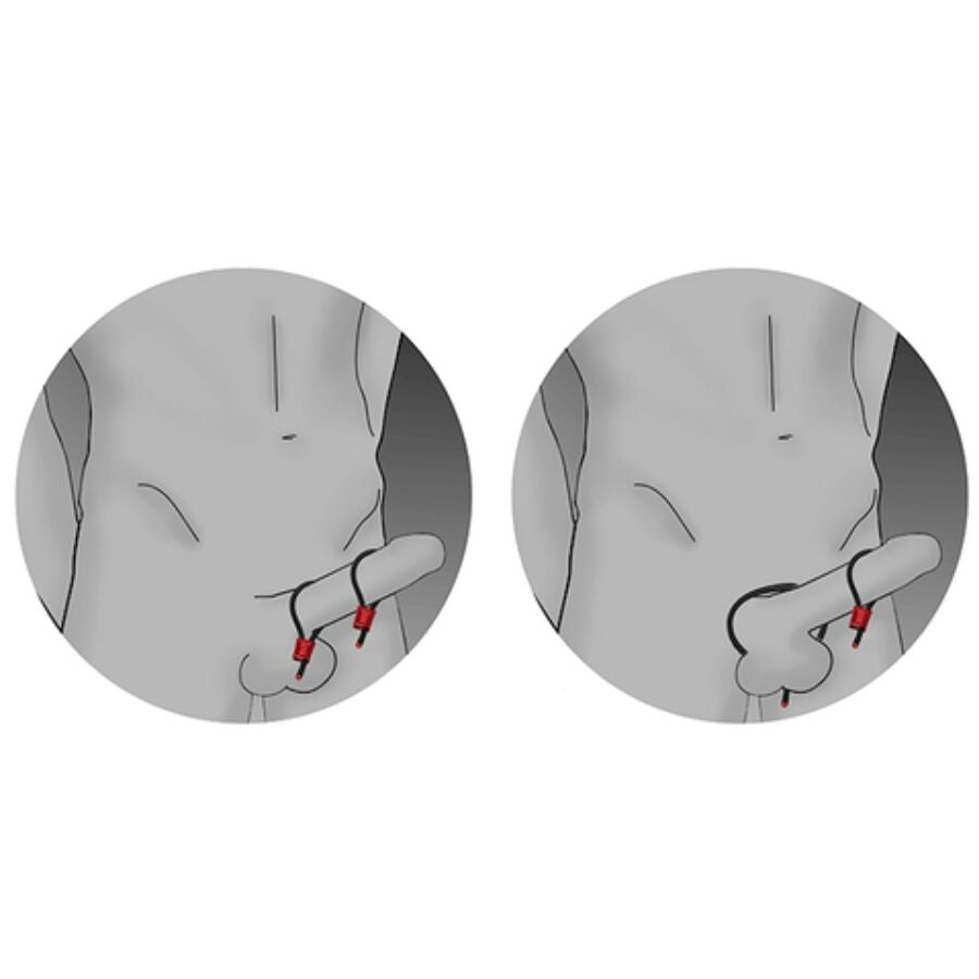 Electrastim Prestige Electraloops 2 X Cockring Rojo Ajustable